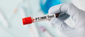 Prothrombin_test_Metropolis-Healthcare